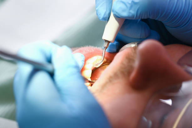 Best Emergency Tooth Extraction in Lake Mohawk, NJ