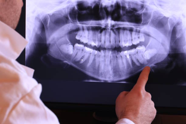 Best Emergency Dental Care for Trauma or Injury in Lake Mohawk, NJ
